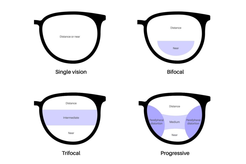 Illustration of four types of lenses with different zones.